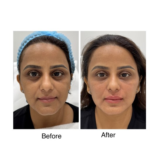 Before and after full face transformation, supplied by Dr. Zaheer Abbas